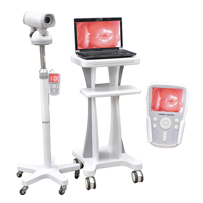 Professional Video Colposcope Endoscope Gynaecology Colposcope CE03