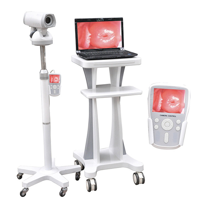 Professional Video Colposcope Endoscope Gynaecology Colposcope CE03